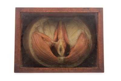 Lot 3 - A 19TH CENTURY WAX ANATOMICAL STUDY OF AN ANUS