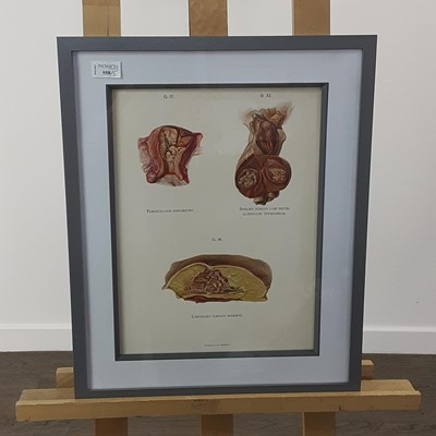 Lot 558 - FOUR PATHOLOGICAL ANATOMY LITHOGRAPHS