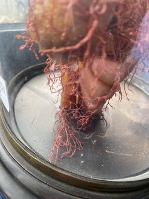 Lot 47 - WAX MEDICAL MODEL OF HUMAN FOOT AND NERVE STRUCTURE