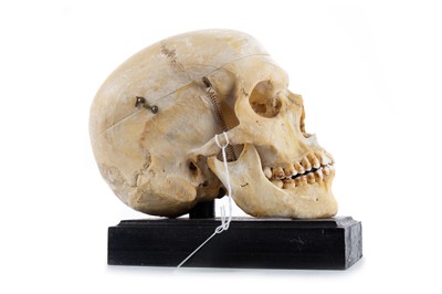 Lot 71 - ANATOMICAL HUMAN SKULL