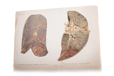 Lot 93 - ATLAS OF PATHOLOGICAL ANATOMY