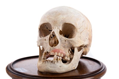 Lot 112 - ANATOMICAL HUMAN SKULL