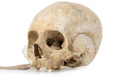 Lot 16 - ANATOMICAL HUMAN UPPER SKULL