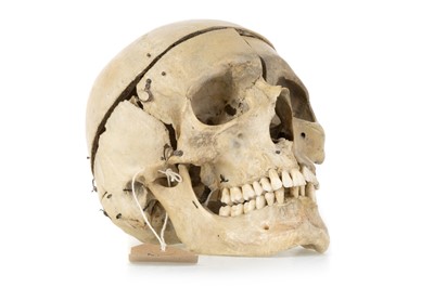 Lot 1056 - ANATOMICAL HUMAN SKULL