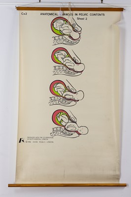 Lot 28 - MEDICAL POSTER, ANATOMICAL CHANGES IN PELVIC CONTENTS BY ADAM ROUILLY