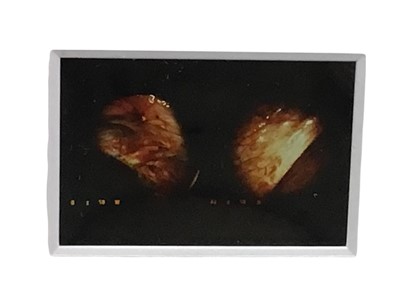 Lot 309 - GROUP OF MEDICAL PHOTOGRAPHIC SLIDES